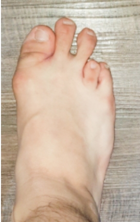 수술전