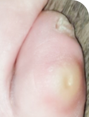 수술전