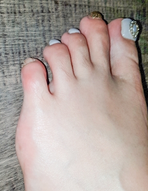 수술전