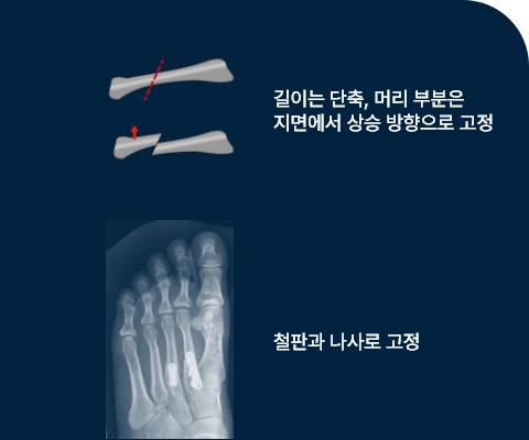 수술전