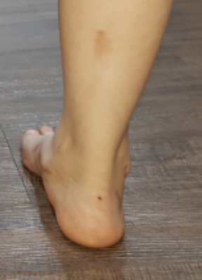 수술후