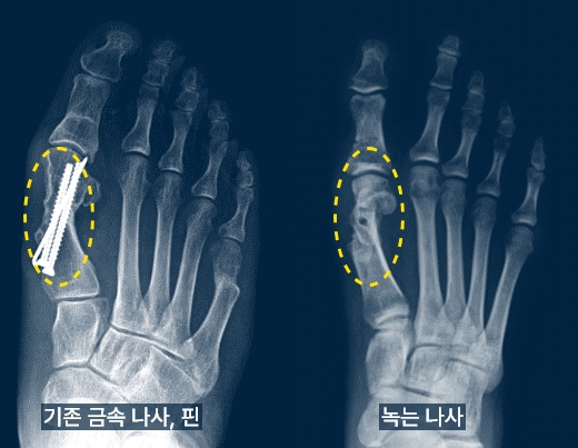 대상