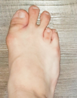 수술전