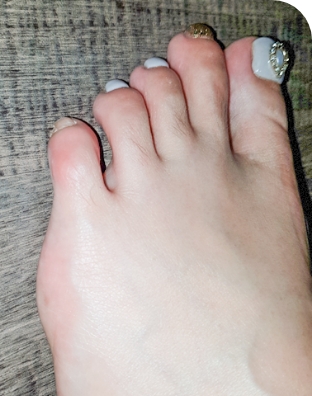 수술전