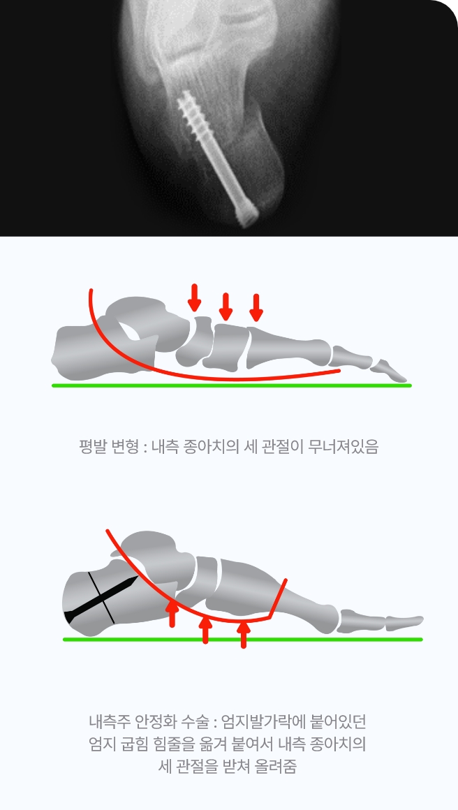 수술후